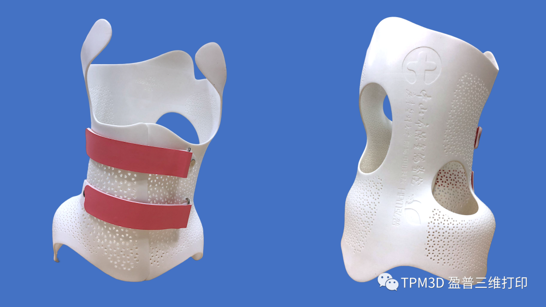 盈普SLS 3D打印脊柱側彎矯形器